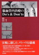 脳血管内治療のｄｏ’ｓ　＆　ｄｏｎ’ｔｓ