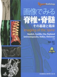 画像でみる脊椎・脊髄―その基礎と臨床