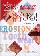 歯が溶ける！ - エロージョンの診断から予防まで