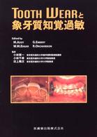 ＴＯＯＴＨ　ＷＥＡＲと象牙質知覚過敏