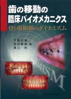 歯の移動の臨床バイオメカニクス - 骨と歯根膜のダイナミズム