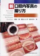 新口腔内写真の撮り方