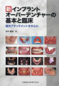新インプラントオーバーデンチャーの基本と臨床 - 磁性アタッチメントを中心に