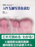 入門Ｘ線写真を読む 補綴臨床ｐｒａｃｔｉｃｅ　ｓｅｌｅｃｔｉｏｎ