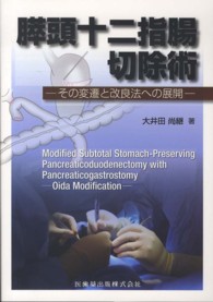 膵頭十二指腸切除術 - その変遷と改良法への展開