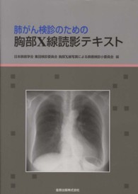 肺がん検診のための胸部Ｘ線読影テキスト