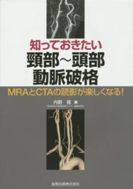 知っておきたい頚部～頭部動脈破格 - ＭＲＡとＣＴＡの読影が楽しくなる！