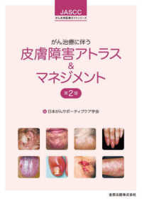 がん治療に伴う皮膚障害アトラス＆マネジメント ＪＡＳＣＣがん支持医療ガイドシリーズ （第２版）