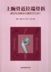 上腕骨近位端骨折 - 適切な治療法の選択のために
