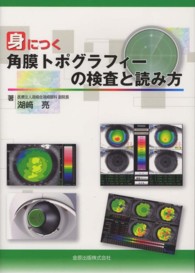 身につく角膜トポグラフィーの検査と読み方