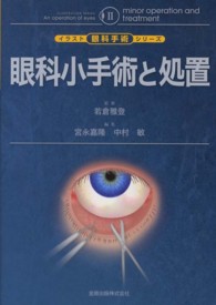 眼科小手術と処置 イラスト眼科手術シリーズ
