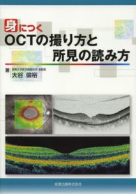 身につくＯＣＴの撮り方と所見の読み方