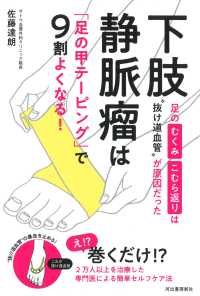 下肢静脈瘤は「足の甲テーピング」で９割よくなる！―足のむくみ・こむら返りは“抜け道血管”が原因だった