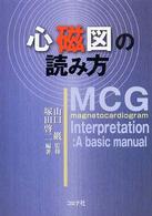 心磁図の読み方