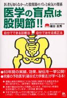 医学の盲点は股関節！！ - 医者も知らなかった股関節のズレと病気の関係