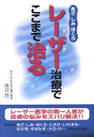 レーザー治療でここまで治る―あざ・しみ・ほくろ