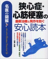 狭心症・心筋梗塞の最新治療と発作を防ぐ安心読本 - 名医の図解