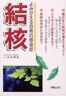 結核 - よみがえる恐怖の感染症