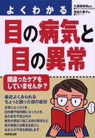 よくわかる目の病気と目の異常
