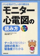 モニター心電図の読み方 - パッと引けてしっかり使える