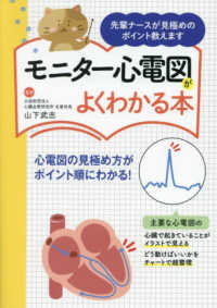 モニター心電図がよくわかる本 - 先輩ナースが見極めのポイント教えます