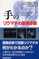 手のリウマチの画像診断