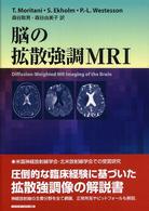 脳の拡散強調ＭＲＩ