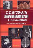 ここまでみえる脳脊髄画像診断 - よくわかる高分解能画像