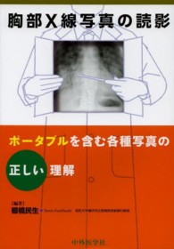 胸部Ｘ線写真の読影 - ポータブルを含む各種写真の正しい理解