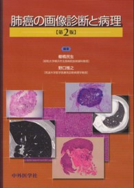 肺癌の画像診断と病理 （第２版）