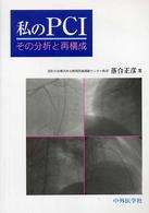 私のＰＣＩ - その分析と再構成