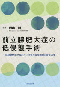 前立腺肥大症の低侵襲手術 - 経尿道的前立腺吊り上げ術と経尿道的水蒸気治療
