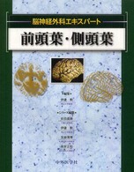 前頭葉・側頭葉 脳神経外科エキスパート