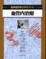 血管内治療 脳神経外科エキスパート