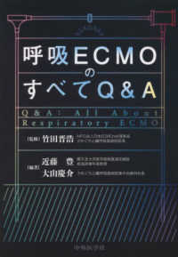 呼吸ＥＣＭＯのすべてＱ＆Ａ