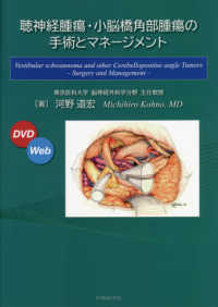 聴神経腫瘍・小脳橋角部腫瘍の手術とマネ－ジメント / 河野道宏 - 紀伊國屋書店ウェブストア｜オンライン書店｜本、雑誌の通販、電子書籍ストア