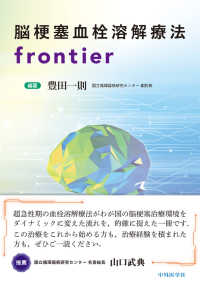 脳梗塞血栓溶解療法ｆｒｏｎｔｉｅｒ