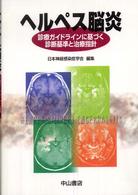 ヘルペス脳炎 - 診療ガイドラインに基づく診断基準と治療指針