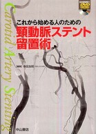 これから始める人のための頸動脈ステント留置術