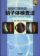 細隙灯顕微鏡による硝子体検査法 - 後部硝子体剥離の診断