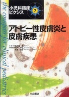 小児科臨床ピクシス 〈７〉 アトピー性皮膚炎と皮膚疾患 大矢幸弘