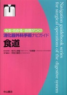 みる・わかる・自信がつく！消化器外科手術ナビガイド 食道