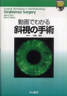 動画でわかる斜視の手術