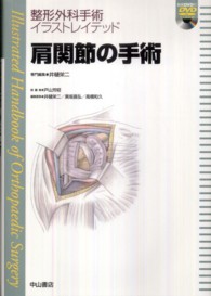 肩関節の手術 整形外科手術イラストレイテッド