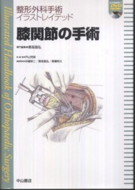 膝関節の手術 整形外科手術イラストレイテッド