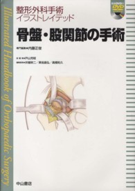 骨盤・股関節の手術 整形外科手術イラストレイテッド