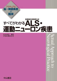 すべてがわかるＡＬＳ・運動ニューロン疾患 アクチュアル脳・神経疾患の臨床