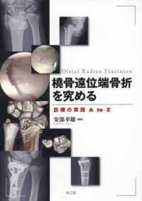橈骨遠位端骨折を究める - 診療の実践Ａ　ｔｏ　Ｚ