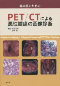 臨床医のためのＰＥＴ／ＣＴによる悪性腫瘍の画像診断