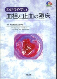 わかりやすい血栓と止血の臨床